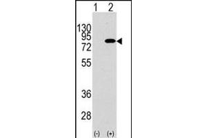 Western blot analysis of PIK3R2 (arrow) using rabbit polyclonal PIK3R2 Antibody  (R).