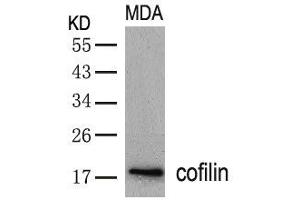 Western blot analysis of extracts from MDA cells using cofilin(Ab-3) Antibody. (Cofilin Antikörper  (AA 1-5))