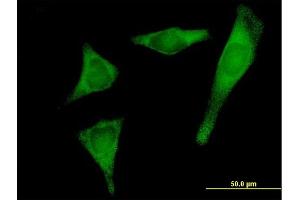 Immunofluorescence of purified MaxPab antibody to PRPSAP2 on HeLa cell. (PRPSAP2 Antikörper  (AA 1-369))