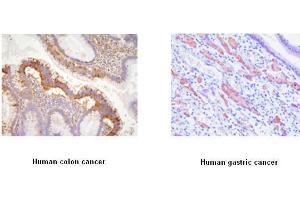 Immunohistochemistry (IHC) image for anti-EPH Receptor A2 (EPHA2) (AA 559-976) antibody (ABIN317512) (EPH Receptor A2 Antikörper  (AA 559-976))