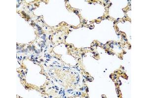 Immunohistochemistry of paraffin-embedded Rat lung using PIP Polyclonal Antibody at dilution of 1:100 (40x lens).