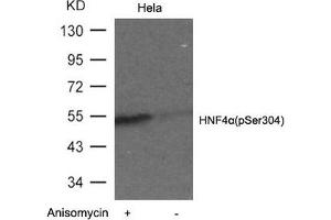 Western blot analysis of extracts from Hela cells untreated or treated with Anisomyclin using HNF4a(Phospho-Ser304) Antibody. (HNF4A Antikörper  (pSer304))