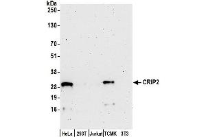 anti-Cysteine-Rich Protein 2 (CRIP2) (AA 75-125) antibody