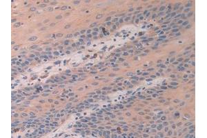 Immunohistochemistry (IHC) image for anti-Activating Transcription Factor 4 (Tax-Responsive Enhancer Element B67) (ATF4) (AA 130-347) antibody (ABIN7433582)
