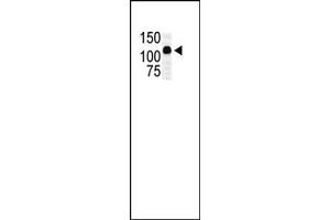 The anti-MLK2 Pab (ABIN392424 and ABIN2842029) is used in Western blot to detect MLK2 in transfected COS7 cell lysate. (MAP3K10 Antikörper  (C-Term))