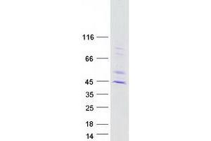 Western Blotting (WB) image for Dihydrodiol Dehydrogenase (Dimeric) (DHDH) protein (Myc-DYKDDDDK Tag) (ABIN2719440)