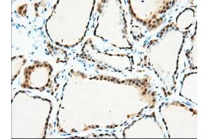 Immunohistochemical staining of paraffin-embedded Human pancreas tissue using anti-BDH2 mouse monoclonal antibody. (BDH2 Antikörper)