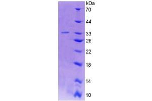 SDS-PAGE analysis of Human GAD2 Protein. (GAD65 Protein)