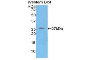 Western Blotting (WB) image for anti-Elastin (ELN) (AA 392-645) antibody (ABIN1174510) (Elastin Antikörper  (AA 392-645))