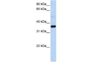 LTB4DH antibody used at 1 ug/ml to detect target protein.