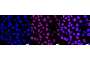 Immunocytochemical staining of HT- cells with PIM1 antibody (ABIN7799837), 1:1,000). (Rekombinanter PIM1 Antikörper)