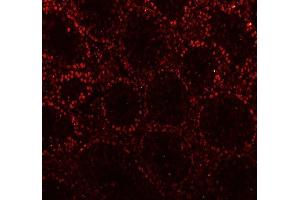 IF analysis of CTBP2 using anti-CTBP2 antibody (ABIN7601326). (CTBP2 Antikörper  (AA 321-445))