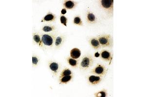 Immunohistochemistry (IHC) image for anti-Early Growth Response 1 (EGR1) (AA 23-43), (N-Term) antibody (ABIN3043997)