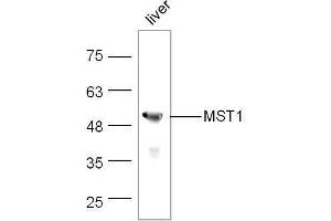 Mouse liver lysates probed with Rabbit Anti-MST1 Polyclonal Antibody, Unconjugated  at 1:500 for 90 min at 37˚C. (MST1 Antikörper  (AA 385-487))