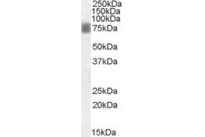 Image no. 1 for anti-NUAK Family, SNF1-Like Kinase, 1 (NUAK1) (Internal Region) antibody (ABIN375083) (NUAK1 Antikörper  (Internal Region))