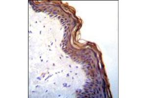 Immunohistochemical staining of formalin fixed and paraffin embedded human skin was performed with KLK7 polyclonal antibody  at 1:10-1:50 dilution followed by indirect peroxidase conjugation with secondary antibody and DAB staining. (Kallikrein 7 Antikörper  (C-Term))