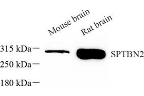 Spectrin, Beta, Non-erythrocytic 2 (SPTBN2) Antikörper