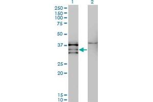 Western Blot analysis of NKX2-5 expression in transfected 293T cell line by NKX2-5 monoclonal antibody (M08), clone 3E3.