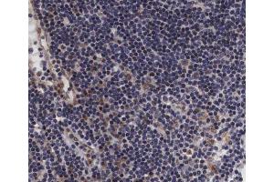 ABIN6267393 at 1/200 staining human lymph node tissue sections by IHC-P. (VAV1 Antikörper  (pTyr174))