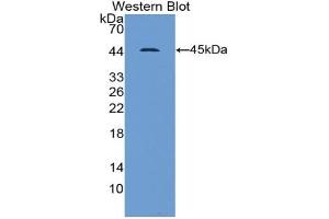 Western blot analysis of recombinant Human Gelsolin. (Gelsolin Antikörper  (AA 674-782))
