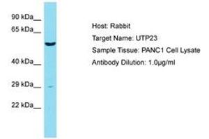 Image no. 1 for anti-UTP23, Small Subunit (SSU) Processome Component, Homolog (UTP23) (AA 151-200) antibody (ABIN6750446) (UTP23 Antikörper  (AA 151-200))