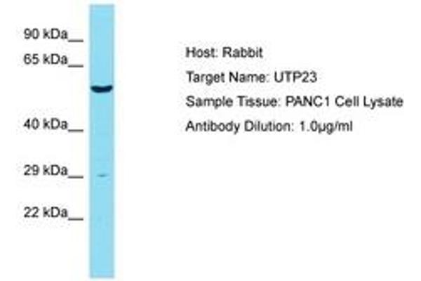 UTP23 anticorps  (AA 151-200)