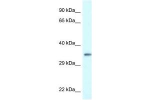 Western Blot showing PDLIM1 antibody used at a concentration of 1 ug/ml against Hela Cell Lysate (PDLIM1 Antikörper  (C-Term))