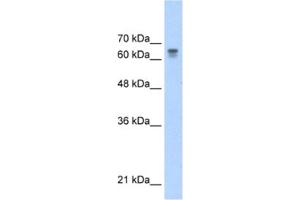 Western Blotting (WB) image for anti-Poly (ADP-Ribose) Polymerase Family, Member 6 (PARP6) antibody (ABIN2460859) (PARP6 Antikörper)
