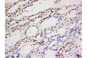 Formalin-fixed and paraffin embedded human kidney labeled with Anti-PIWIL1 Polyclonal Antibody, Unconjugated  at 1:200 followed by conjugation to the secondary antibody and DAB staining. (PIWIL1 Antikörper  (AA 551-650))