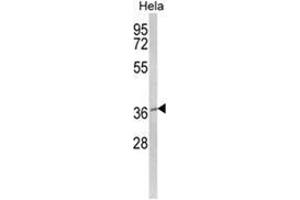 Western blot analysis of MOSC2 Antibody (C-term) in Hela cell line lysates (35ug/lane). (MARC2 Antikörper  (C-Term))