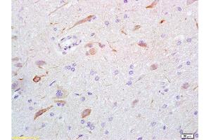 Formalin-fixed and rat brain tissue labeled with Anti-GABA Polyclonal Antibody, Unconjugated  at 1:200 followed by conjugation to the secondary antibody and DAB staining (GABA Antikörper)