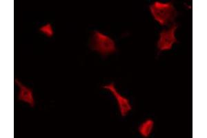ABIN6269322 staining NIH-3T3 by IF/ICC. (FAK Antikörper  (Internal Region))