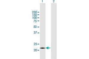 Western Blot analysis of MID1IP1 expression in transfected 293T cell line by MID1IP1 MaxPab polyclonal antibody. (m1ip1 Antikörper  (AA 1-183))