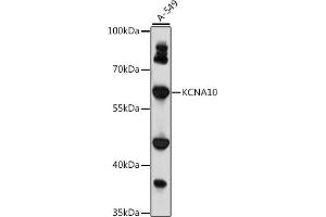 Western blot analysis of extracts of A-549 cells, using KCN antibody (ABIN7269485) at 1:1000 dilution. (KCNA10 Antikörper  (AA 1-125))