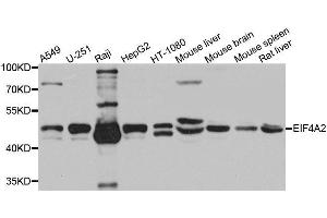 Western blot analysis of extracts of various cell lines, using EIF4A2 antibody. (EIF4A2 Antikörper  (AA 1-270))
