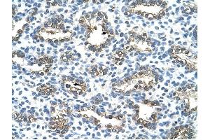 Cytokeratin 13 antibody was used for immunohistochemistry at a concentration of 4-8 ug/ml to stain Alveolar cells (arrows) in Human Lung. (Cytokeratin 13 Antikörper  (C-Term))