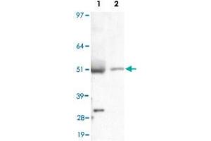 Detection of LIPF in liver lysate using LIPF polyclonal antibody .