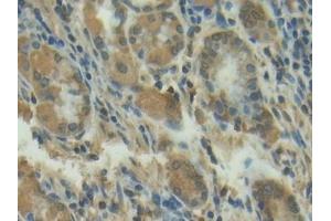 Immunohistochemistry (IHC) image for anti-Matrix Metallopeptidase 13 (Collagenase 3) (MMP13) (AA 103-290) antibody (ABIN7430978)
