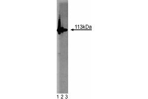 Western blot analysis of PARP on Jurkat cell lysate. (PARP1 Antikörper  (AA 22-219))
