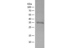 BHLHE41 Protein (AA 419-482) (His-IF2DI Tag)
