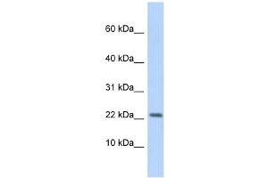 P2RX7 antibody used at 1 ug/ml to detect target protein. (P2RX7 Antikörper  (Middle Region))