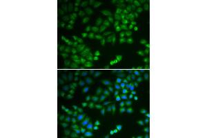 Immunofluorescence analysis of MCF-7 cells using RPL5 antibody (ABIN5971027). (RPL5 Antikörper)