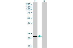 Western Blotting (WB) image for anti-Peroxiredoxin 2 (PRDX2) (AA 1-199) antibody (ABIN598967) (Peroxiredoxin 2 Antikörper  (AA 1-199))