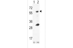 Western blot analysis of GCK using rabbit polyclonal hGCK-S418 using 293 cell lysates (2 ug/lane) either nontransfected (Lane 1) or transiently transfected (Lane 2) with the GCK gene.