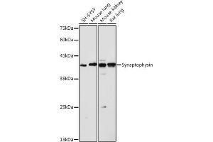 Western blot analysis of extracts of various cell lines, using Synaptophysin antibody (ABIN6135349, ABIN6148783, ABIN6148784 and ABIN6221958) at 1:1000 dilution. (Synaptophysin Antikörper  (AA 150-250))