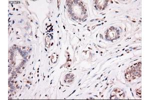 Immunohistochemical staining of paraffin-embedded breast using anti-Nog (ABIN2452676) mouse monoclonal antibody. (NOG Antikörper  (AA 28-232))
