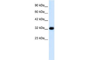 WB Suggested Anti-HS747E2A Antibody Titration:  1. (C22orf31 Antikörper  (Middle Region))