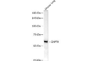 Western blot analysis of extracts of Mouse lung, using Z antibody (ABIN7271430) at 1:1000 dilution. (ZAP70 Antikörper)
