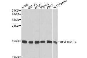 Western blot analysis of extracts of various cell lines, using HIST1H2BG antibody. (HIST1H2BG Antikörper)