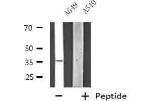 Western blot analysis of extracts from HeLa cells, using ZNF691 antibody. (ZNF691 Antikörper  (Internal Region))